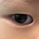 송탄안과의원 이미지