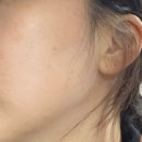 더맑은 | 춘천 퇴계동 에스테틱 더맑은스킨 피부관리 후기