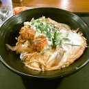 리라치과의원 | 악궁확장장치 돌리기 후기 (코/얼굴변화)