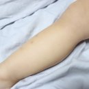 아르아토 이미지