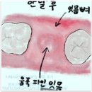 라페치과의원 네이버블로그
