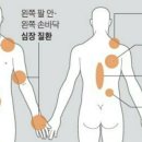 팔 아파서 병원 갔더니 심장질환 이미지