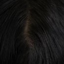 (주)뉴트리바이오 | 여성 탈모 주사 효과