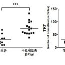 [기사] 서울대병원, 소아 악성 뇌종양 수모세포종 바이오마커 발굴 이미지