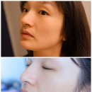 상보빌딩 | 마산내서피부관리 밍스킨케어 트로이필 후기 피부 속부터 맑아지는 변화