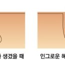 더블유왁싱 네이버블로그