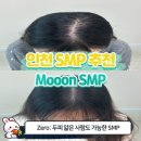[정수리커버 SMP 후기] 꼼꼼한 원장님과 함께라면 아프지 않고 자연스럽게 끝!