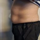 주엠제이에너지 | 괴정복부관리 추천 누워서 편하게 부작용없는 냉동지방분해시술 엠제이뷰티샵