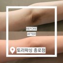 토리샵 | 종로왁싱 토리왁싱 종로점, 바이뮬리로 피부톤 환해진 후기