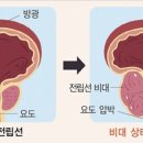 민메디칼 네이버블로그