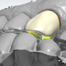 날개치과기공소 이미지