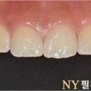 필치과기공소 이미지