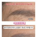 옛날눈썹문신 색소지우개로 통증없이 제거!울산 동구 위드유뷰티