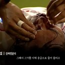 본안과 Daum카페