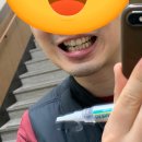 뉴소망약국 | 치아미백, 치아색이 곧 그 사람의 인상을 결정한다, 약국에서파는 뉴더마썬 사용기