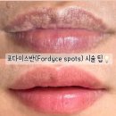 앵두피부관리