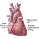 ﻿심혈관 질환의 종류와 증상은 무엇인가? 이미지