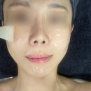 은브로우앤뷰티(겸스킨) 에서 BIT면역관리 받고 온 후기