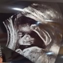 광역시도70-3L | [일상 기록] 임신 24-26주차(아기용품준비, 임당검사)