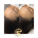 가비헤어 이미지