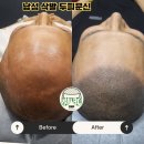 GS25남순천점 | [공지] 순천 삭발 두피문신 후기 | 40대인데 50대로 보인다는 말 듣고 결국 상담 받았습니다.