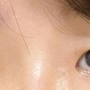 N안경콘택트 이미지