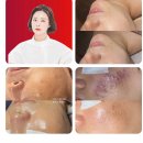 태강프라자 | 에스테틱 추천 경성에스테틱 하이세라 효과 본 제니룸스킨위드바디 솔직후기 대연동피부관리 팔자주름 해결