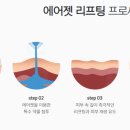 노블레스피부과의원 이미지