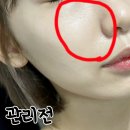 하이피네일 | 서면피부관리 중요한날엔 이브뷰티센터 가야지~