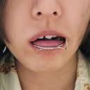 드림라인치과교정과치과의원 | 안면비대칭 교정 후기 ; 강남 미소드림치과