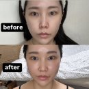 (주)이작 | 벌써 마지막? 듀얼소닉 최종 before/after 후기