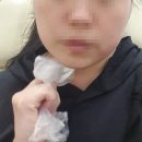 더고운의원 | 제주도 피부과 &#39;더고운의원&#39; 브이로 리프팅 내돈내산 리얼후기