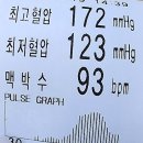 고혈압의 합병증 | 고혈압 낮추는 방법 영양제