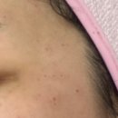 능곡예인의원 이미지