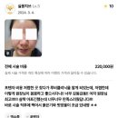 에이미의원 | 에이미의 엄청 일상 : 포텐자, 실펌, 엑소좀, 쥬베룩,연아앰플, 필업