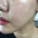 인셀덤금빛 | 40대화장품 인셀덤 좋다길래 사용해본 전후비교 현실후기