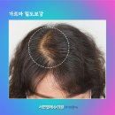 명지헤어라인