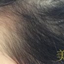개미헤어아트
