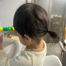 일산 자이언성형외과의원 :: 20개월 아이 봉합 꿰맴 후기