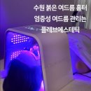 수원-0739 | 수원여드름관리 플레브에스테틱 붉은 염증성여드름 진정관리 후기