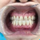 앤기공소 이미지