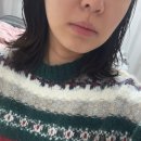 경산바른약국 | 대구 경산 피부과 인모드 fx+슈링크 200샷 잘하는 곳 (전/후 비교, 경과 사진)