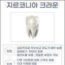 리더스치과기공소 이미지
