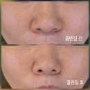 OK샵 | 대구 동천동 피부관리 MS에스테틱 | 예민한 피부도 OK, 진짜 맞춤 관리 후기