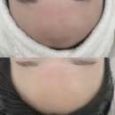 유앤바이오 | 청주 송절동 / 유앤데이 에스테틱 / 청주 피부관리 추천 / 신부관리 / 깐복숭아 케어 / 스킨플래닝