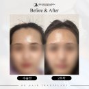 아름다운헤어라인 - 안양시 만안구 | 아름다운헤어라인
