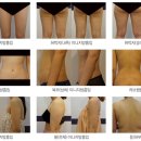 강남연세라인의원 이미지