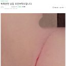 초4가 연필로 초2 얼굴 그어놓은거 보셨어요?(사진주의) 이미지