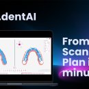 디에스덴탈 이미지