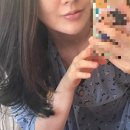 인생 첫 입술필러 생생한 후기, 중동피부과(비포애프터 효과, 국산필러, 수입필러, 주의사항)